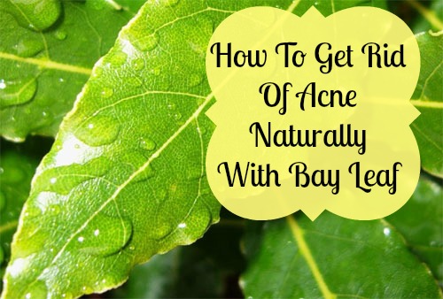 How to Get Rid of Acne Naturally With Bay Leaf