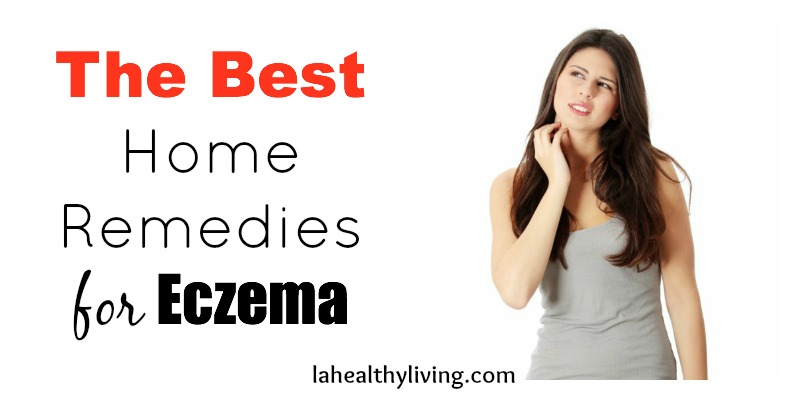 The Best Home Remedies for Eczema 