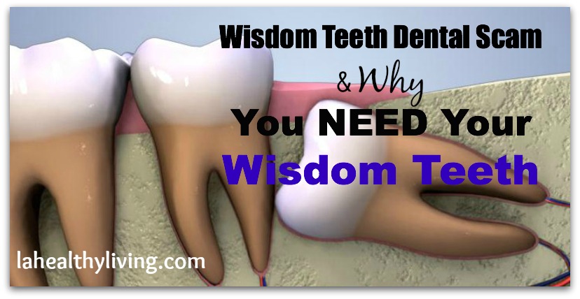 Wisdom Teeth Dental Scam & Why You Need Your Wisdom Teeth